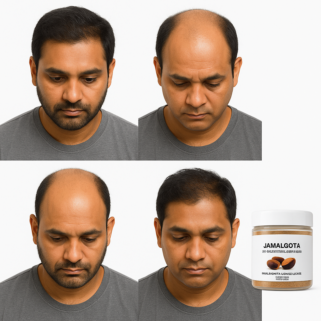 Jamalgota Ayurvedic Hair Growth Powder(2) - 1 Month Supply